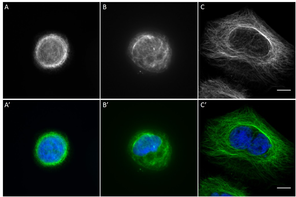 Fig. 12 Human keratin 13 network density of AK13-1 cells